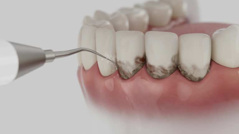 Reliable Dental contractor in Pahrump, NV by Smile Center Dentistry